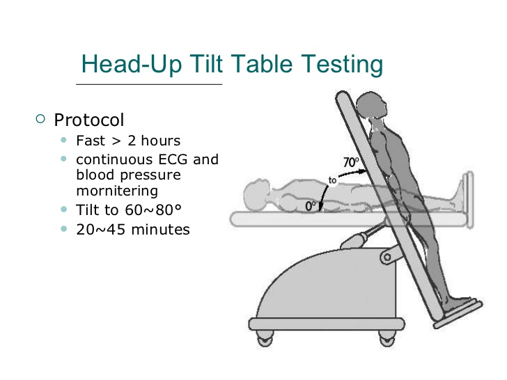 열정♡임상 기립경 검사(HeadUp Tilt Table Test) 네이버 블로그