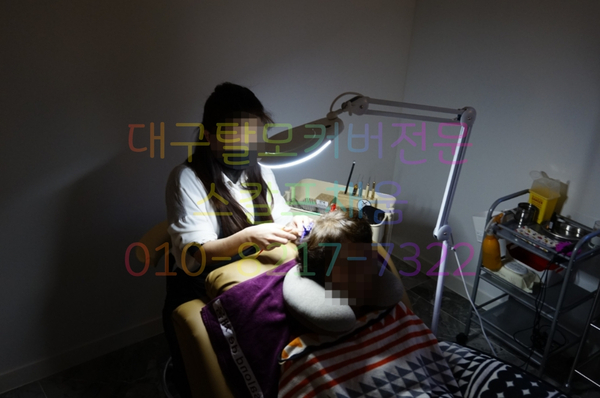 대구가발스칼프채움 이미지