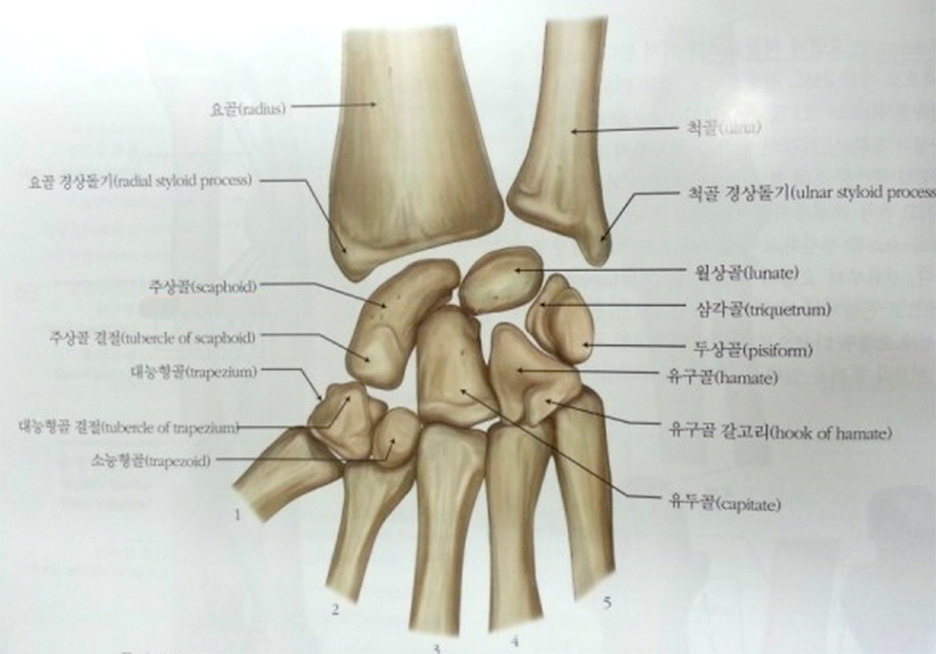주상골골절(손배뼈)의 증상과 치료 : 네이버 블로그